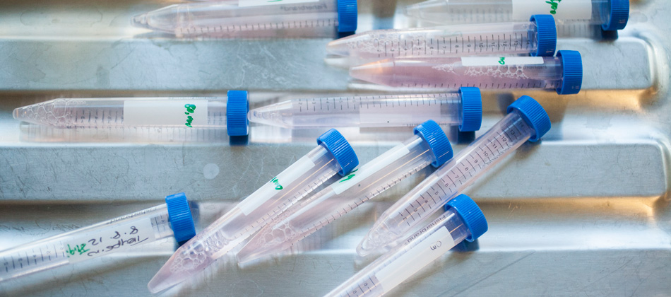 日本医学直博申请流程(PhD,临床型,基础型)